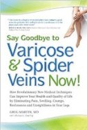 Varicose Veins Books